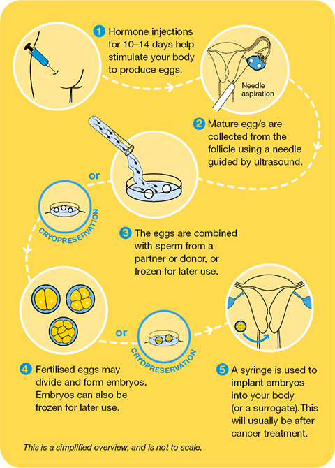 Female Options Before Cancer Treatment | Cancer Council NSW