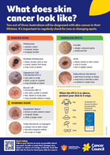 Can you spot skin cancer poster cover thumbnail