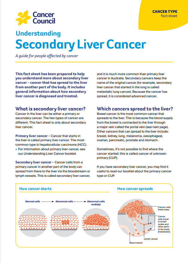 Understanding Secondary Liver Cancer cover thumbnail