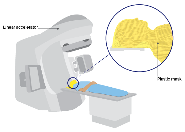 Diagram of linear accelerator