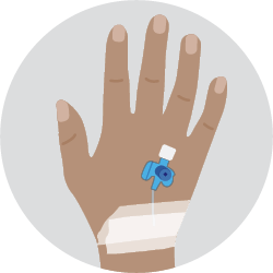 Diagram of Cannula
This is a small plastic 
tube inserted into a vein
in your arm or the back
of your hand.