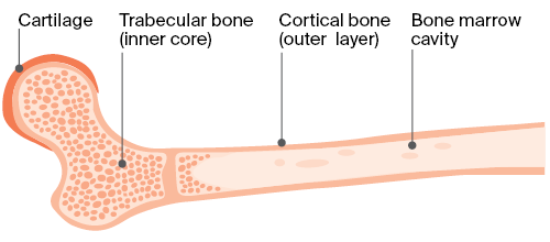 Bone structure