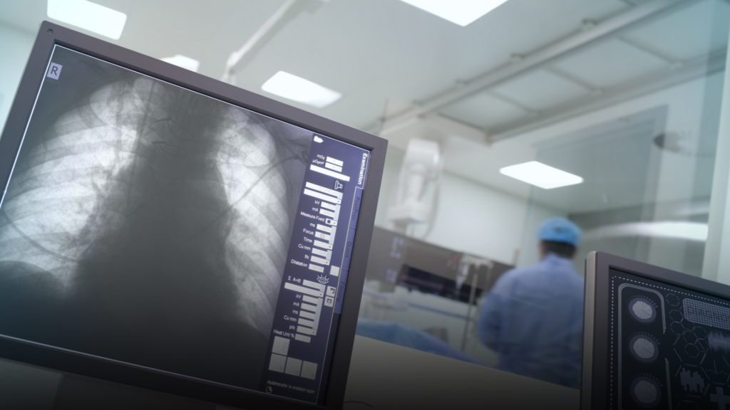 A lung cancer screening in progress, with the results on the technicians screen.